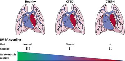 Chronic Thromboembolic Pulmonary Hypertension – What Have We Learned From Large Animal Models